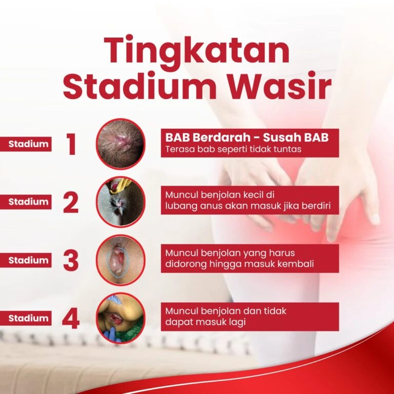 obat wasir obat ambeien obat hemoroid ambefree