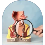 obat ambeien obat wasir obat hemoroid obat fistula ani